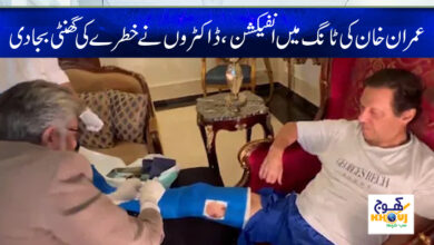imran khan leg