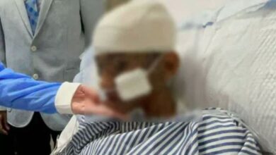 rizwana first surgury