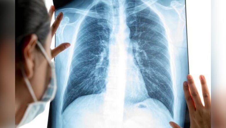 ai technology for cancer patient