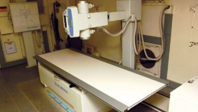 X-ray machines of government hospitals in Lahore are damaged
