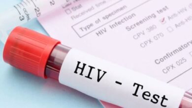 hiv test