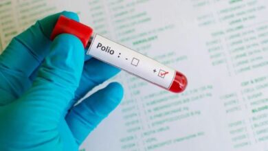 polio virus