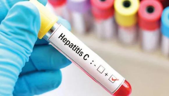 hepatites c