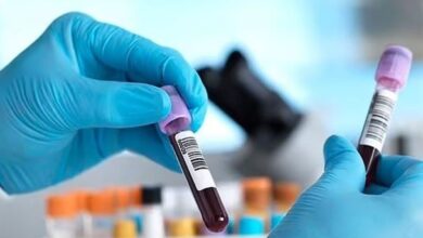 blood test