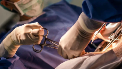 child operation
