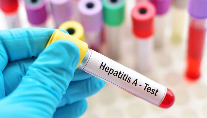 hepatitis a