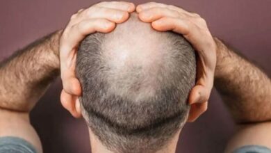 hair fall in seven days