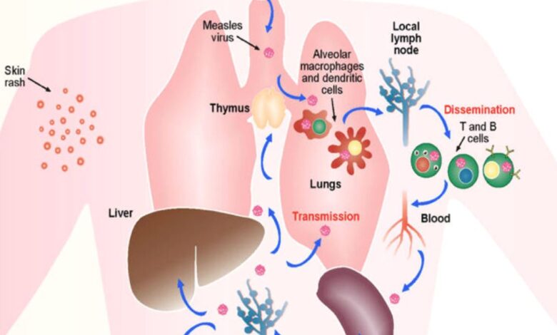 spread of measles in humans