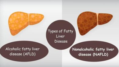 fatt on liver