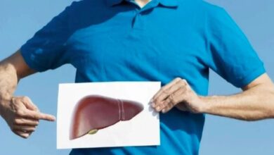 Liver issue