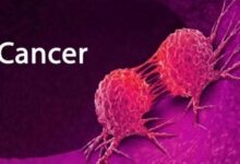 cancer