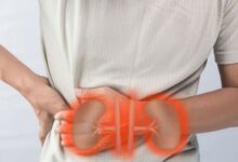kidney pain