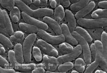 new bacteria virus in america