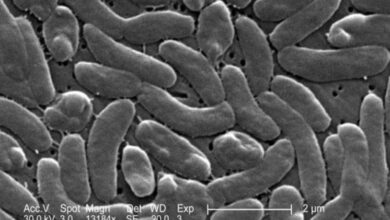 new bacteria virus in america
