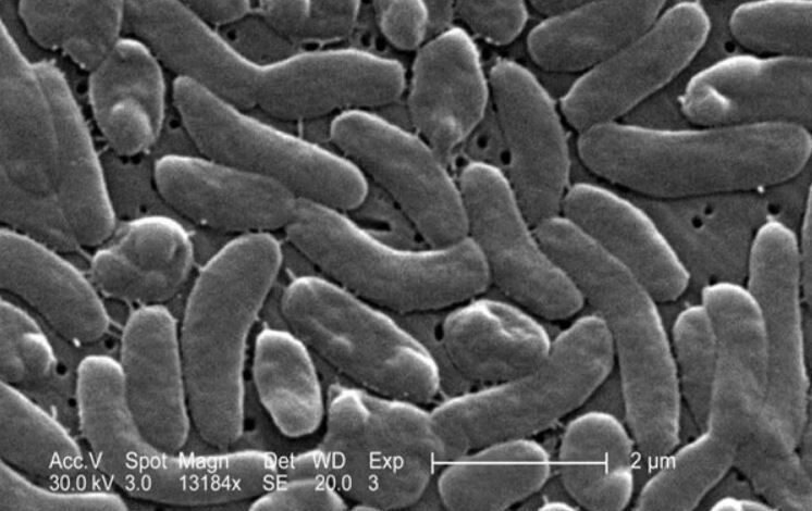 new bacteria virus in america