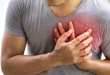 heart attack